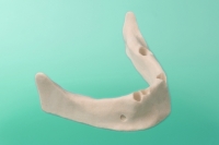 Unterkiefer mit Zahnfortsatz 10-3020