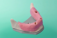 Unterkiefer mit Zahnfortsatz 10-3000
