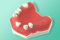 Kiefer mit den Zähnen 10-5070