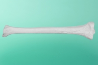 Linker Schienbeinknochen    20-1000