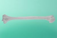 Kość ramieniowa lewa