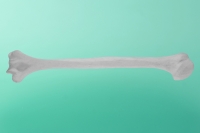 Oberarmknochen, links    50-2000