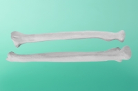 Knochen des linken Oberarms     80-1000