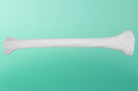 Linker Schienbeinknochen    20-2000