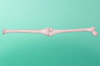 Staw kolanowy duży lewy 40-1000