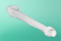 Linker Schienbeinknochen mit einem kanal      20-1900