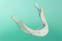 Żuchwa standardowa z pogrubionym wyrostkiem 10-1010