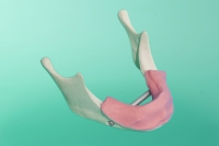 Żuchwa standardowa  ze śluzówką i elementem mocującym 10-1100