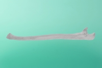 Knochen des Elle 80-1100