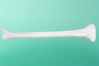 Rechter Schienbeinknochen    20-2001