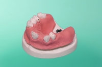 Model szczęki 10-5030