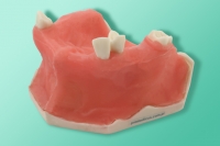 Model częściowo bezzębnej szczęki z zatokami i ze śluzówką 10-3058