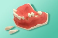 Model szczęki ze śluzówką 10-5085