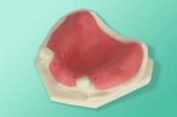 Model szczęki częściowo bezzębnej 10-5018