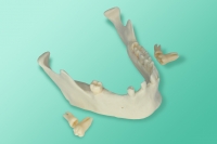 10-1038 Model żuchwy przeznaczony do nauki ekstrakcji zębów