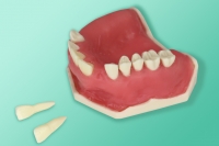 10-5086 Model szczęki ze śluzówką do techniki przeszczepu śluzówki