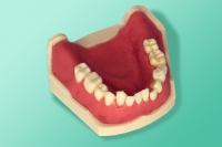 Model ortodontycznyl 10-3152