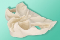 Model szczęki do implantacji zygomatycznej 10-5042