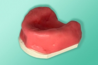 Modell eines zahnlosen Oberkiefers 10-5012