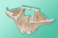 10-5044 Model dla implantów pterygoidalnych